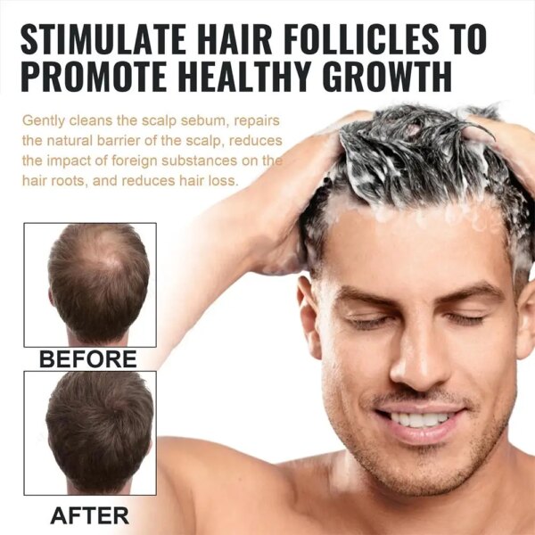 Anti Baldness Shampoo - Image 4