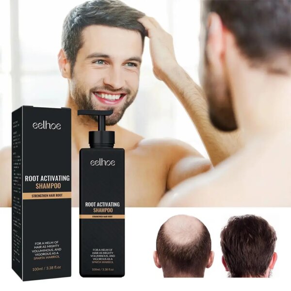 Anti Baldness Shampoo - Image 2