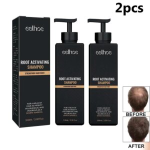 Anti Baldness Shampoo