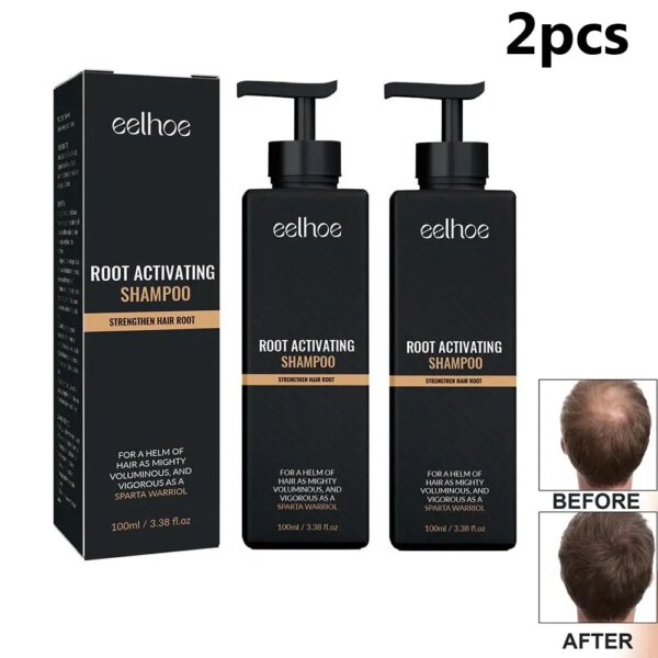 Anti Baldness Shampoo