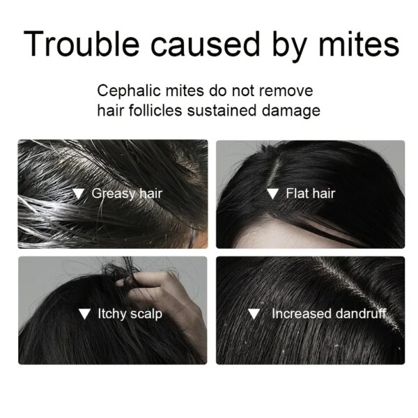 Salt Shampoo For Hair Deep - Image 3