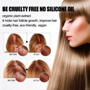 Alternative view of Natural Ginger Shampoo Soap Reduce Hair
