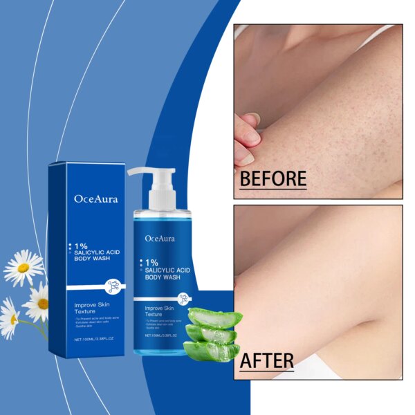 Oce Aura Salicylic Acid Shower Gel - Image 2